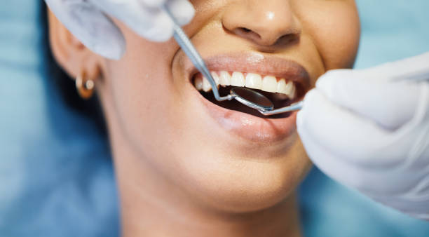 Best Broken or Chipped Tooth Repair in Ainsworth, NE
